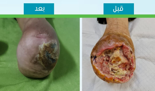 حالة علاج 1