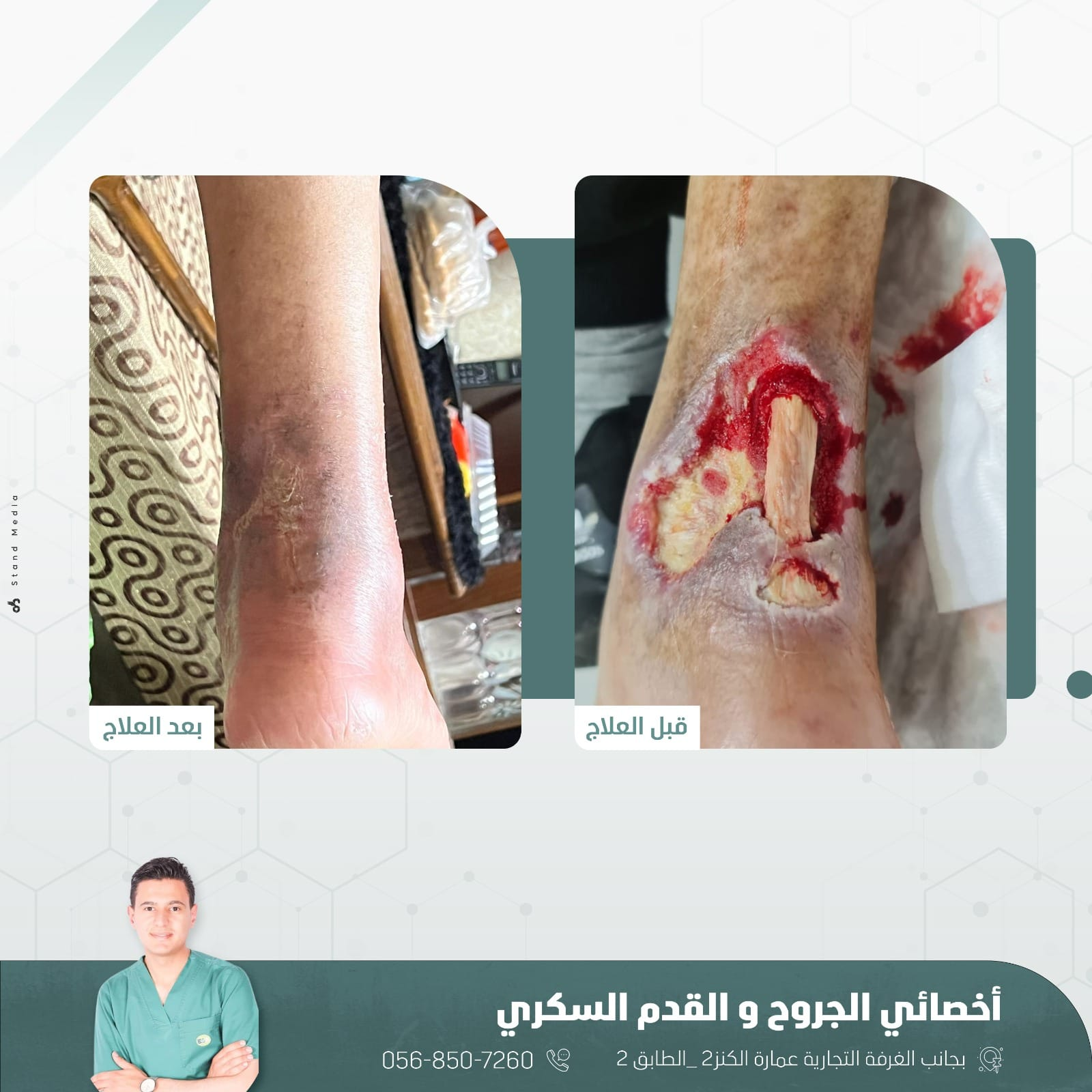 حالة علاج 4