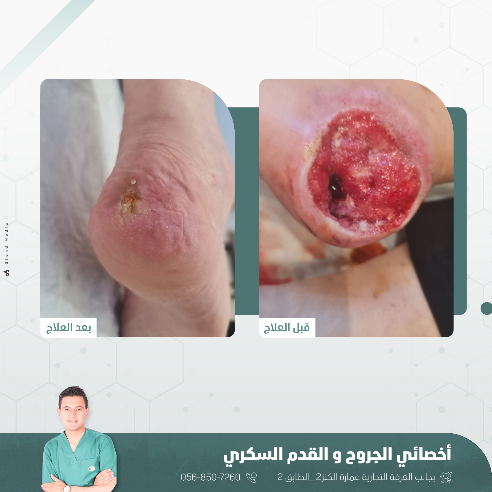 حالة علاج 5