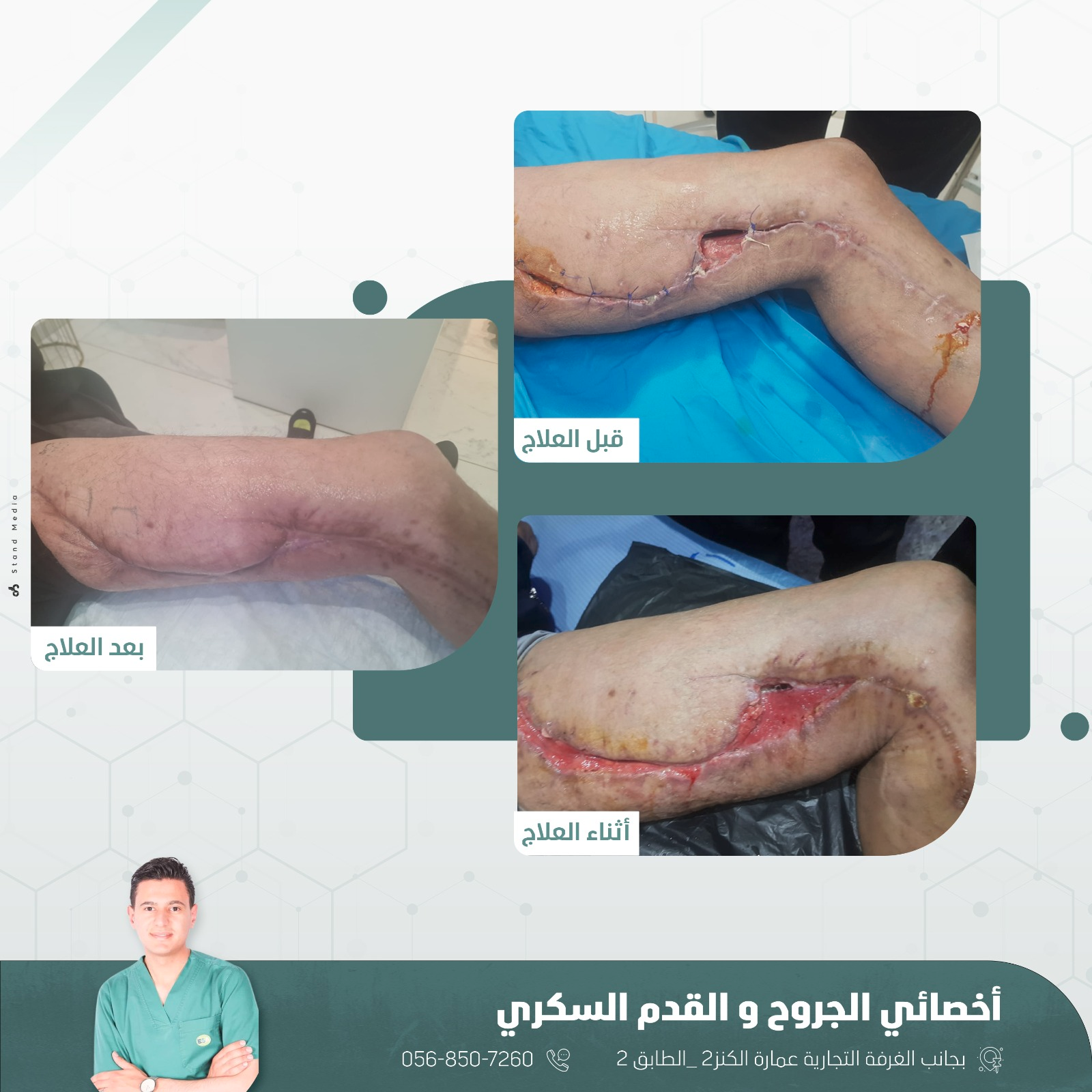 حالة علاج 6