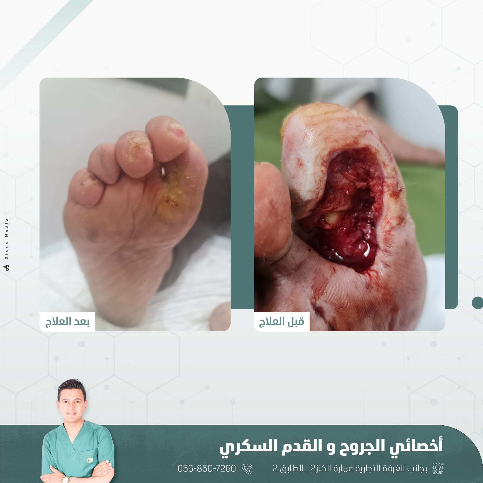 حالة علاج 7