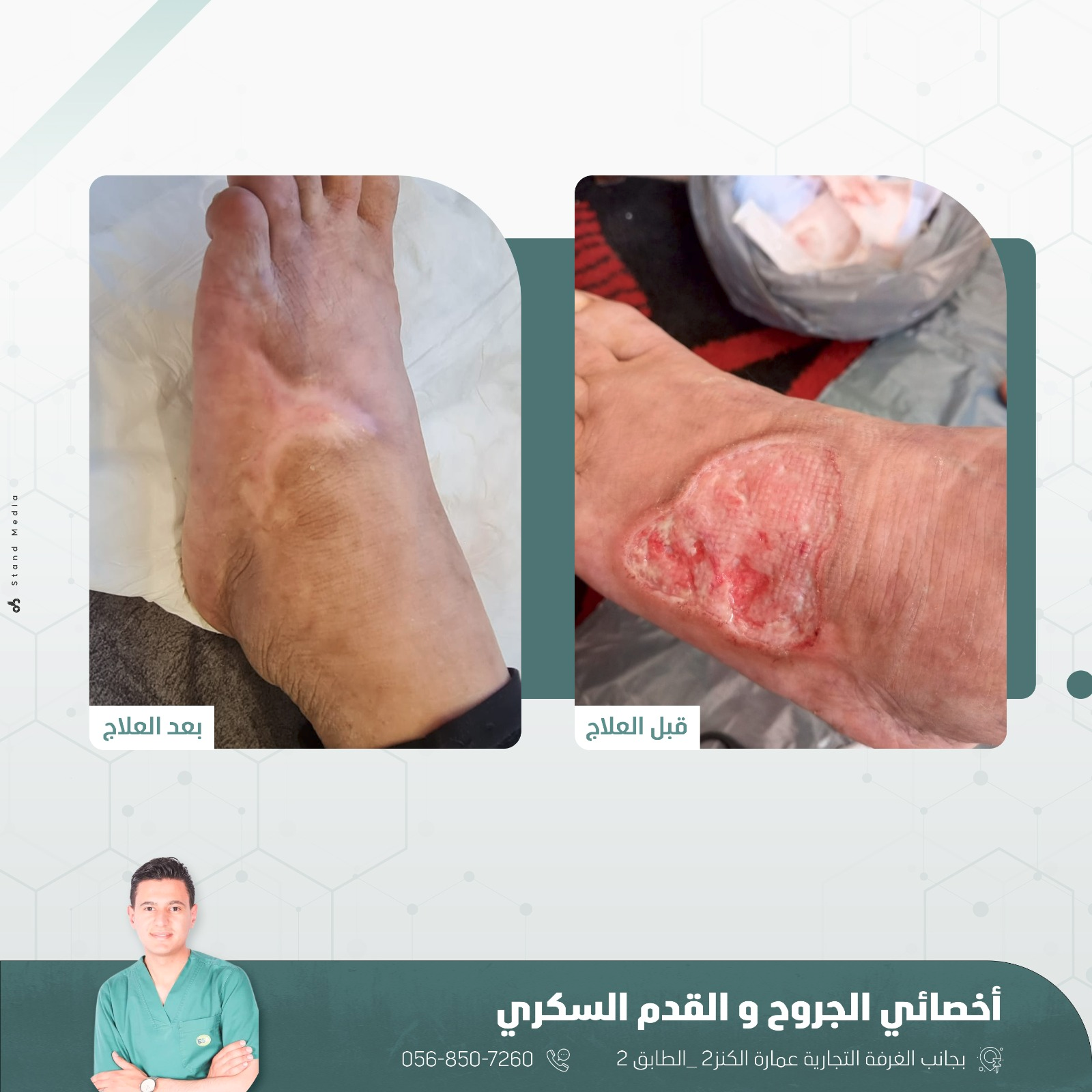 حالة علاج 8